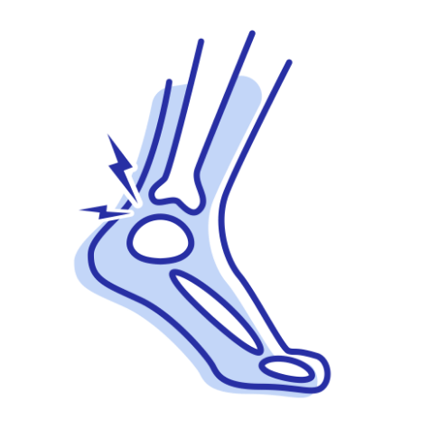 Ankle Pain Treatment Thornbury - Northcote